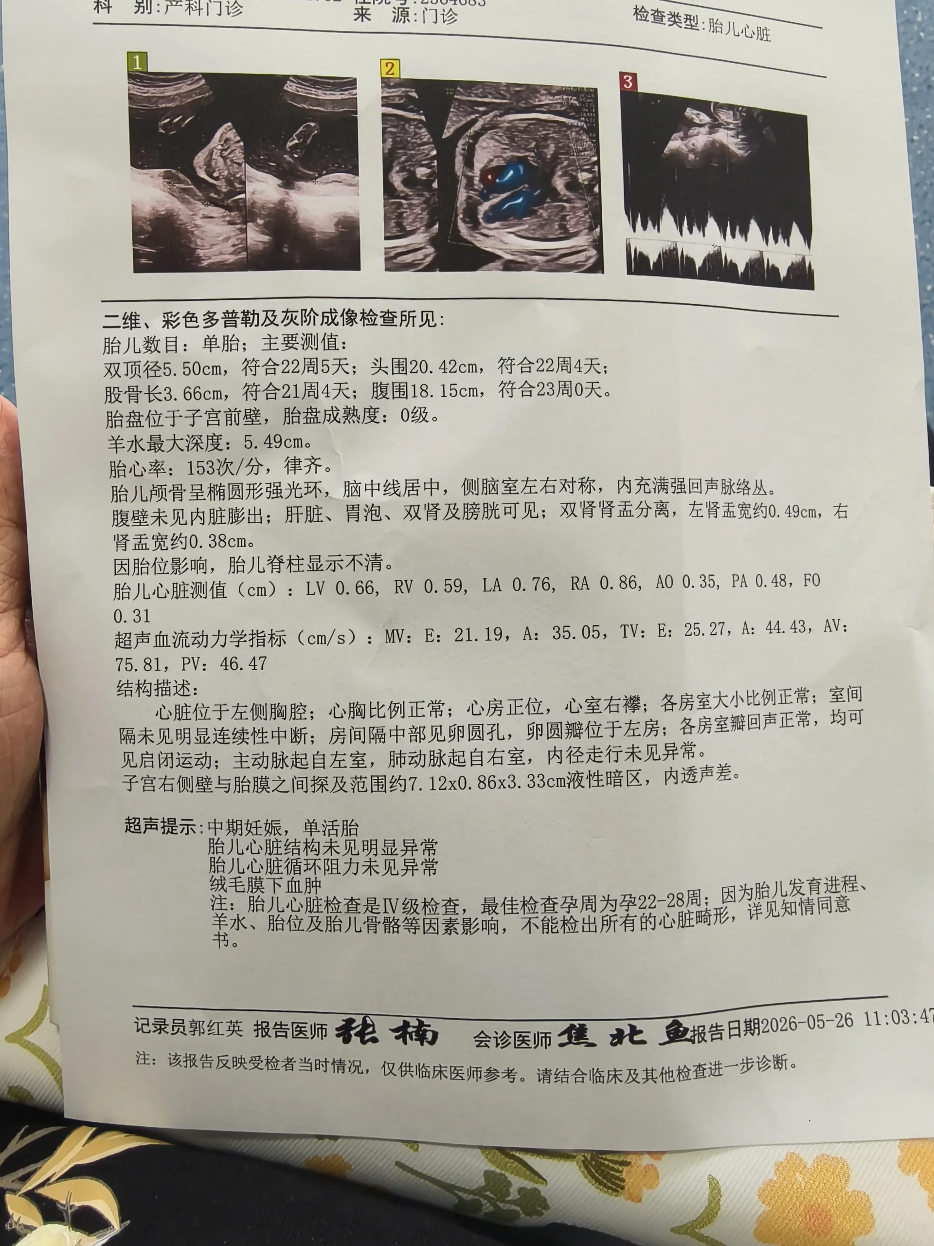 5月26日胎儿心脏超声报告