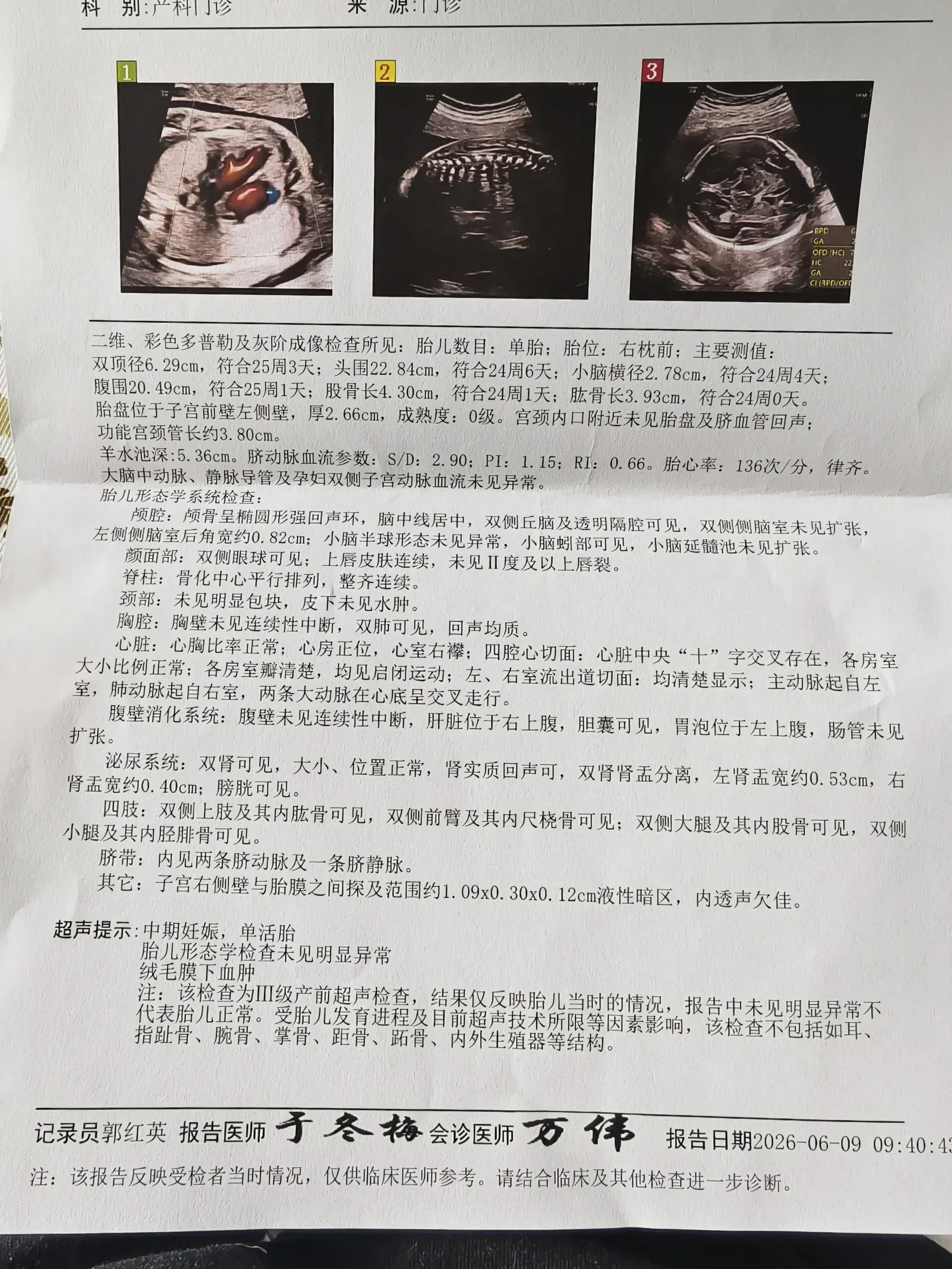 6月9日正式四维彩超报告