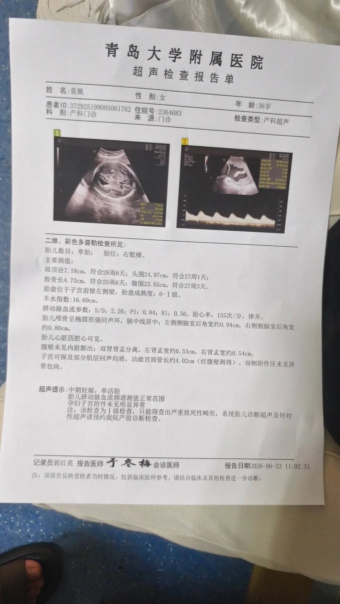6月23日28周超声报告