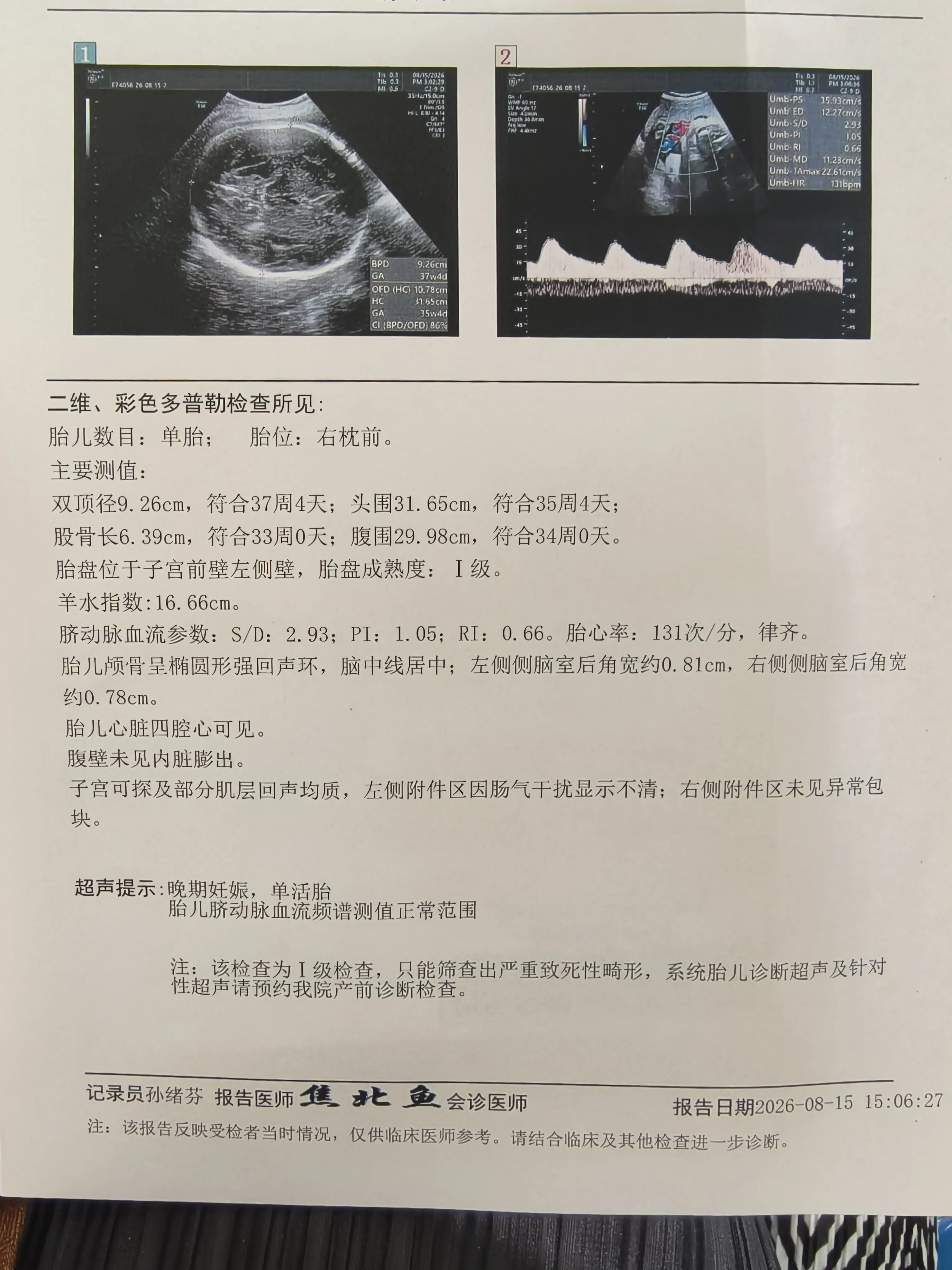 8月15日36周产检报告