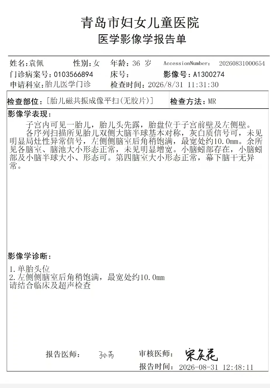 8月31日胎儿颅脑MRI报告