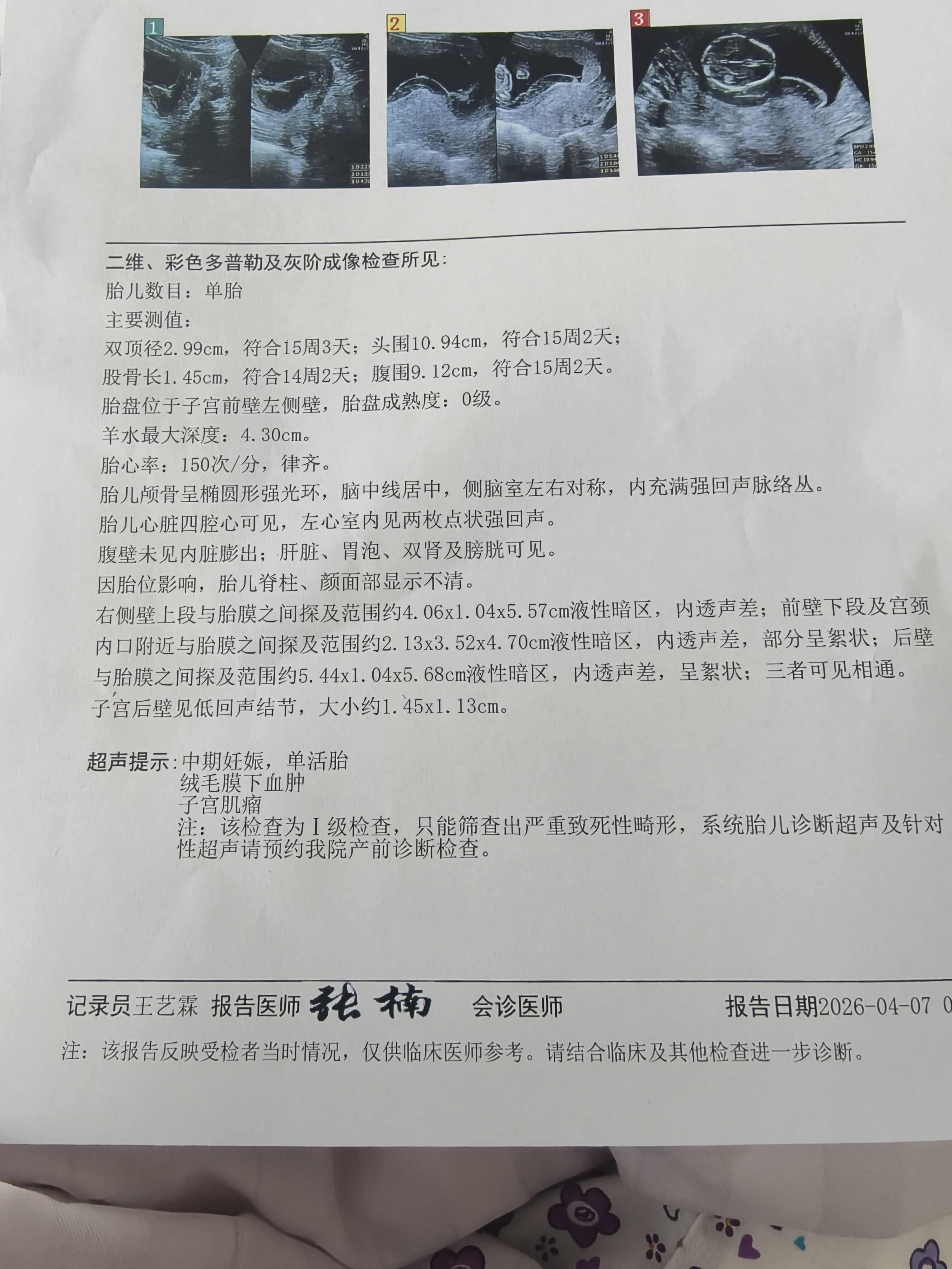 4月7日B超报告