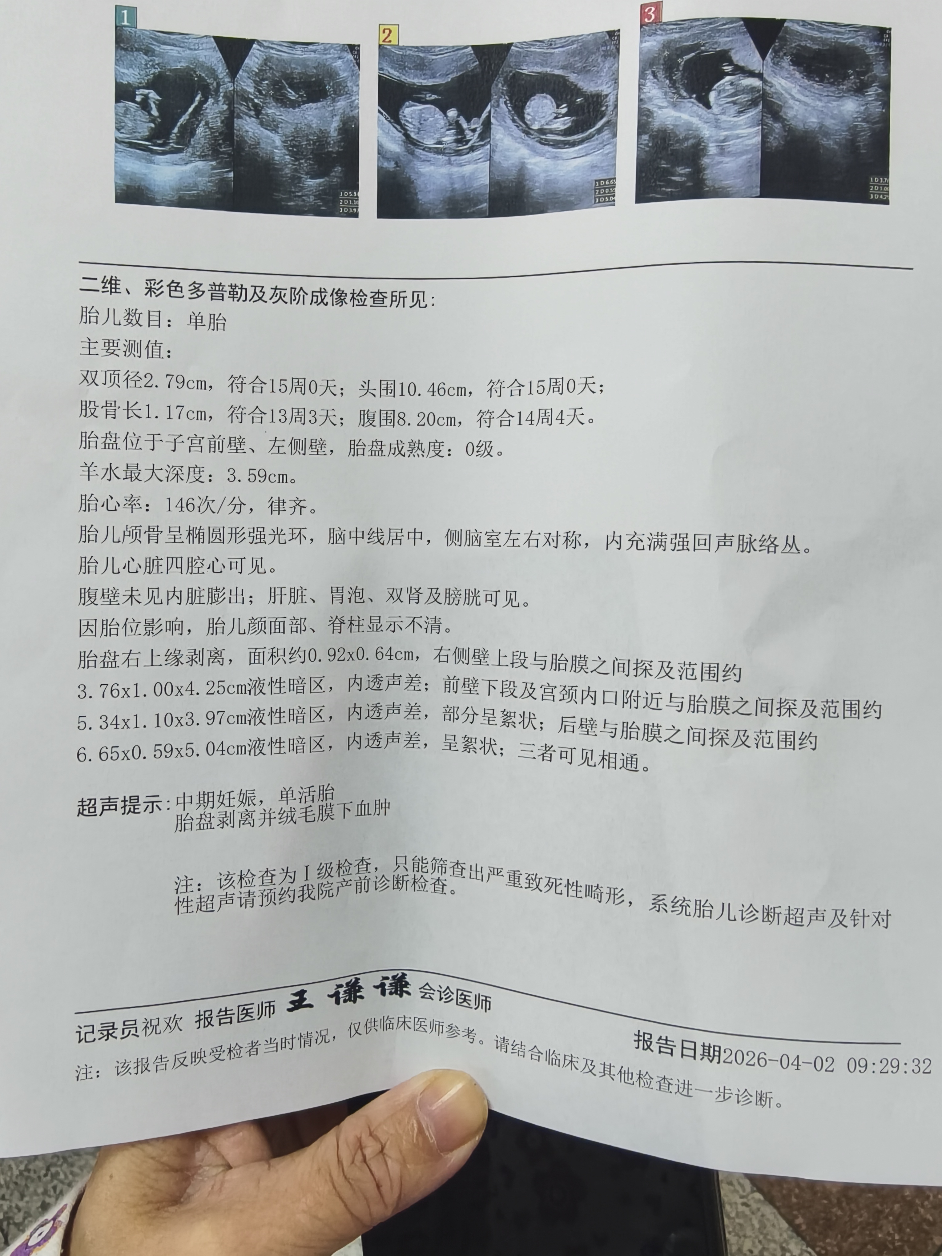 4月2日B超报告